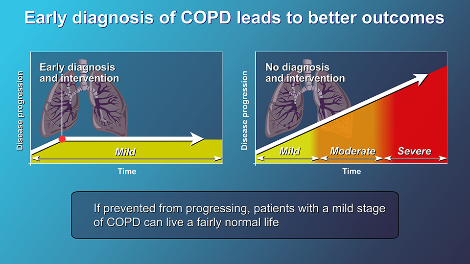 Animation - Diagnosis and Evaluation of COPD