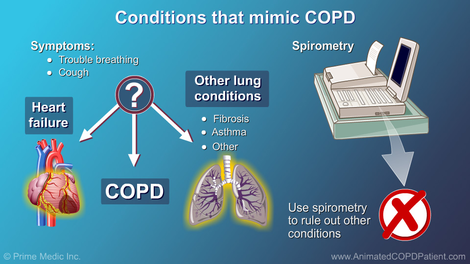 thesis topics in copd